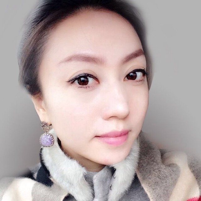 橙意家人表示 智能穿戴与医疗并不遥远(图14)